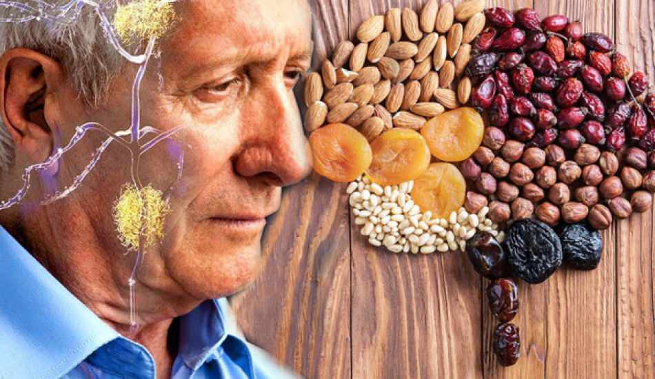 Alzheimer nedir ve belirtileri nelerdir? Alzheimer'in tedavisi var mıdır? İyi gelen besinler...